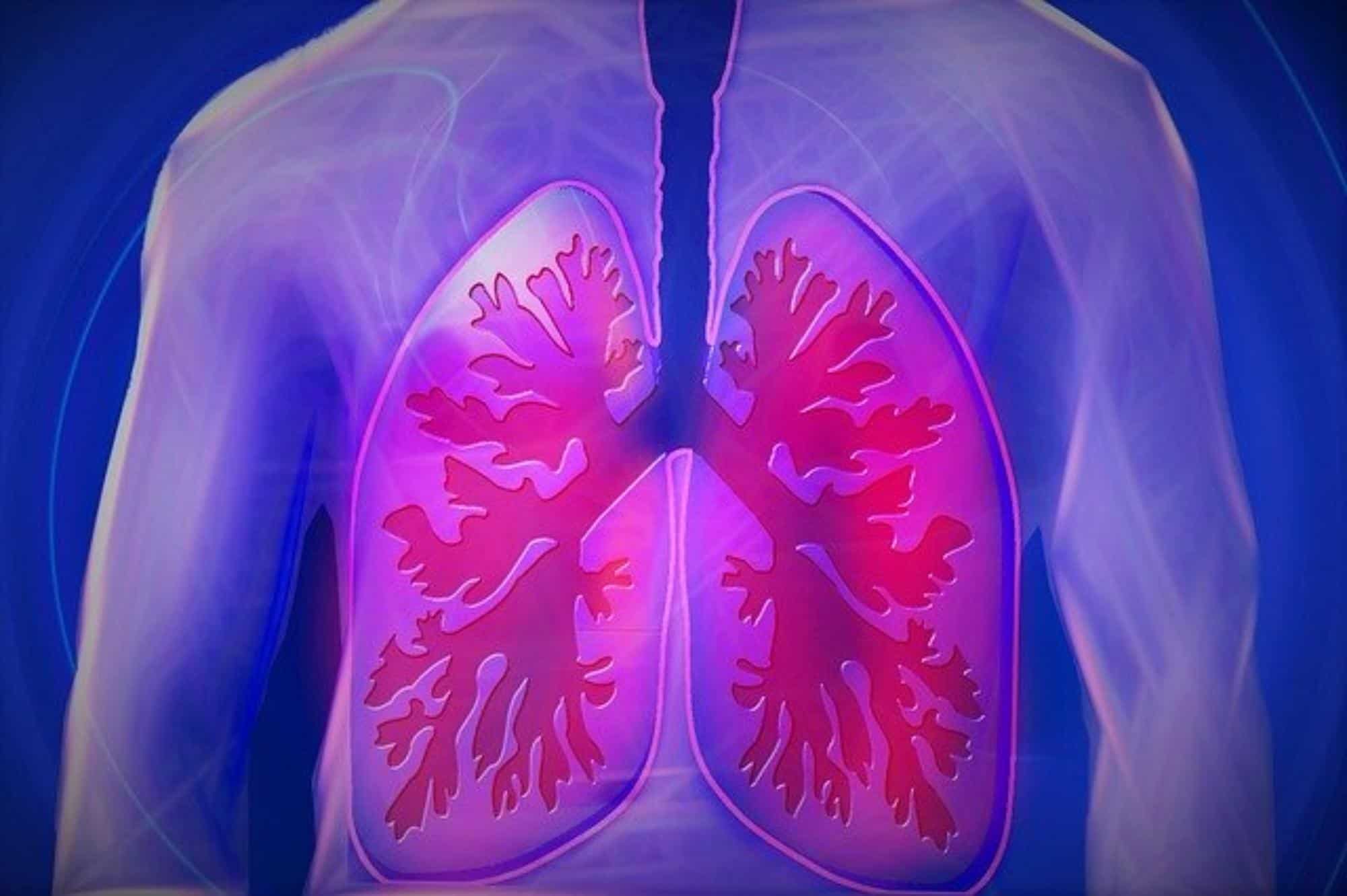 TB is a contagious lung infection